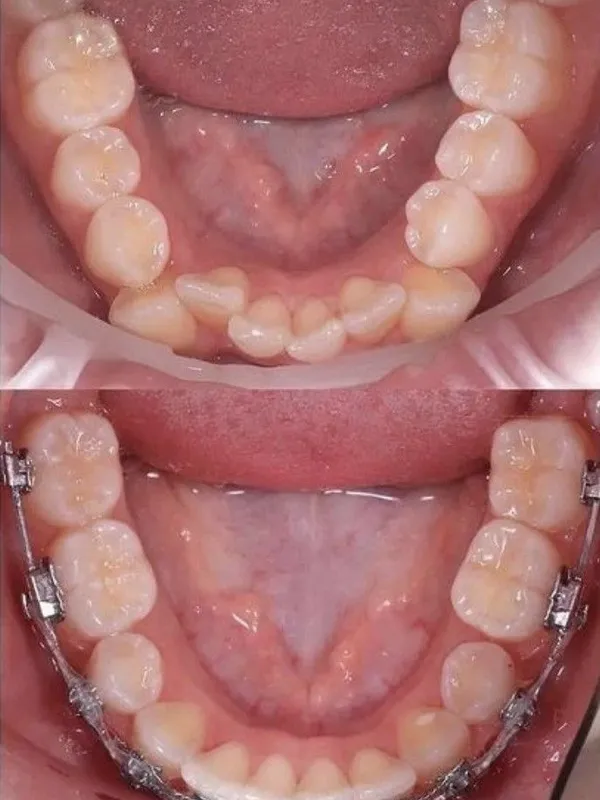 Beneficios de la ortodoncia